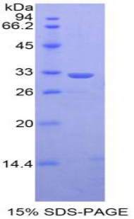 SDS-PAGE